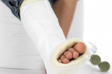 girl with a broken leg